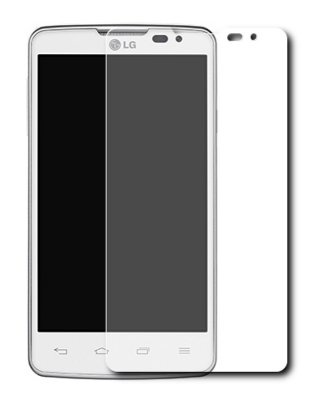    LG LG X145 L60 Ainy 